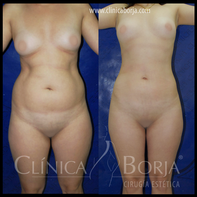 abdomen