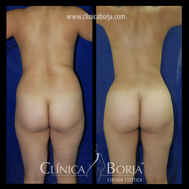 abdomen