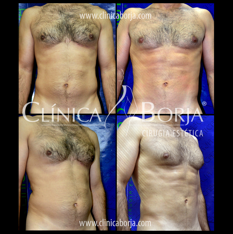 abdomen